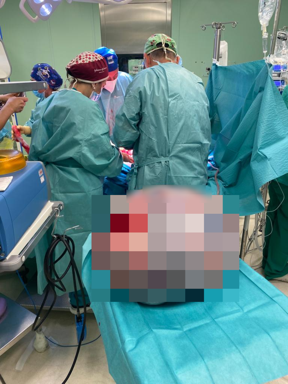Tumori, a Roma asportato un tumore ginecologico di 45 kg
